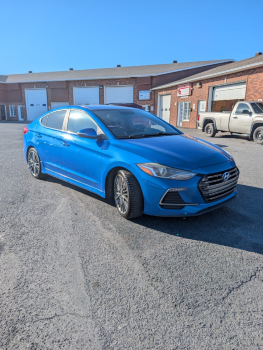 162 hyundai elantra - view 2