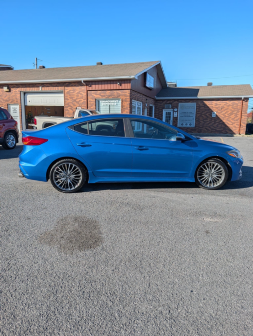 162 hyundai elantra - view 3