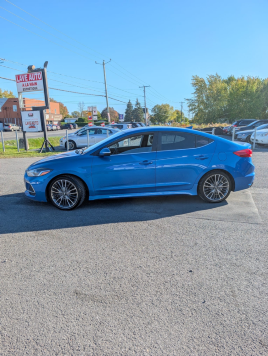 162 hyundai elantra - view 4